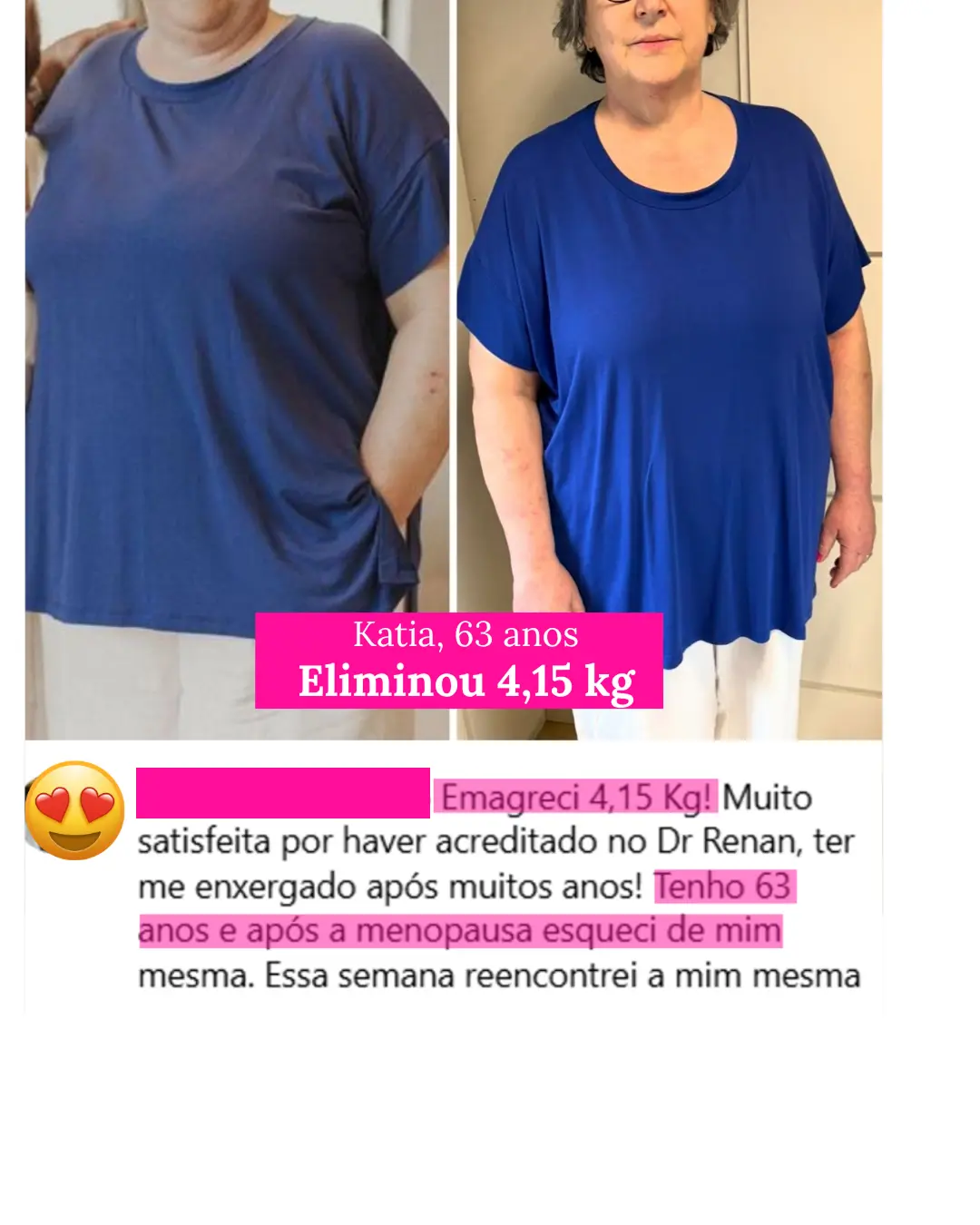 Resultado de aluna da Imersão Renascer Magra